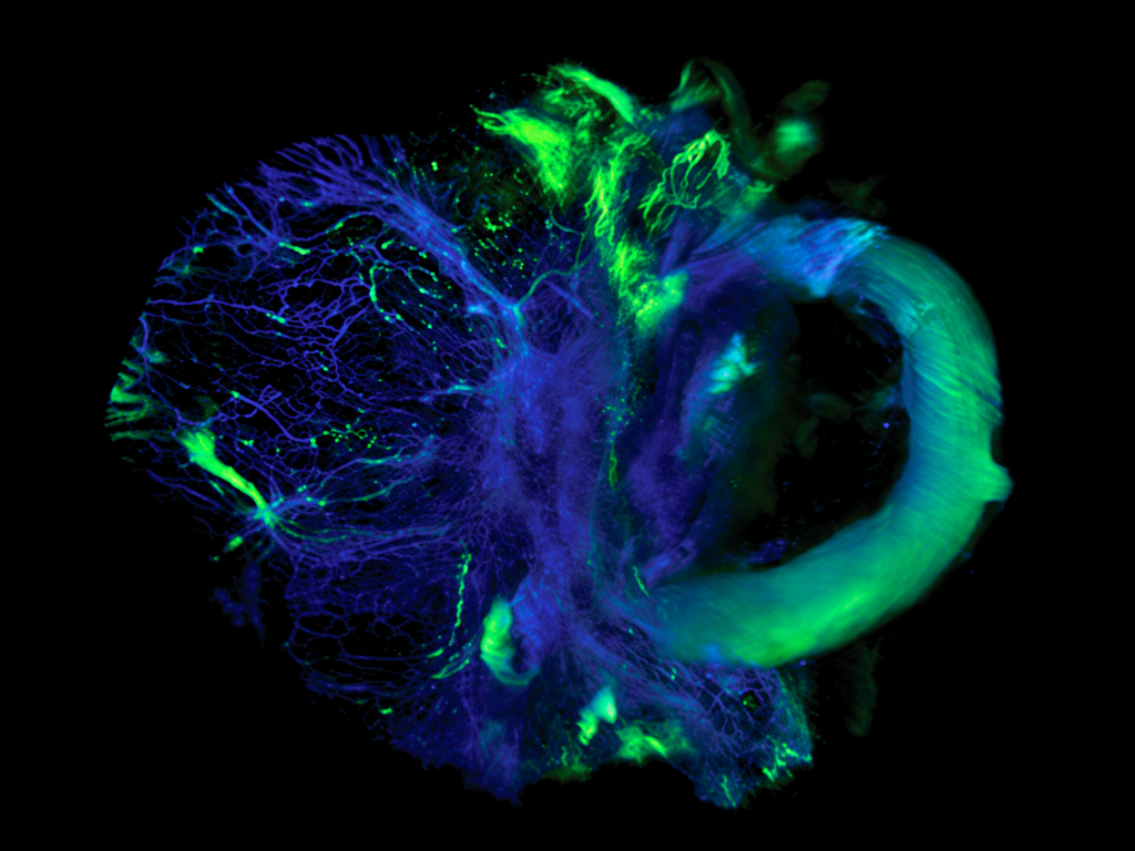 AI-upscaled fluorescence reconstruction of a melanoma explant with CD31 staining in blue and autofluorescence in green
